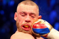 Asi quedó el rostro de Conor McGregor tras recibir 170 golpes de Mayweather
