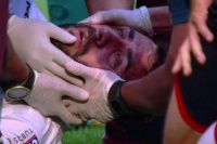 Video: Pratto tuvo que ser internado tras sufrir conmoción cerebral por un rodillazo