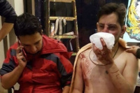 Indignante: hinchas de Wilstermann recibieron una brutal golpiza