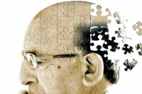  El plan de unos neurólogos para vencer al Alzheimer