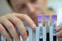 Avance: crearon un test de sangre capaz de detectar de forma temprana 8 tipos de cáncer