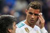 Así quedó la cara de Cristiano Ronaldo después del terrible golpe