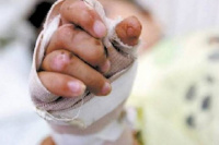 Confirmaron que un nene de 8 años perdió tres dedos de su mano por usar pirotecnia