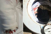 Un nene de 3 años sufrió graves lesiones en su brazo al meterlo en un secarropas