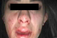 En Chimbas, un hombre atacó a las piñas a su novia de 20 años