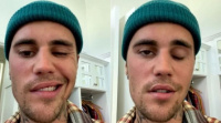 Justin Bieber confesó que sufre de parálisis en la mitad del rostro: “Es muy grave”