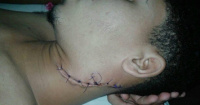 Chimbas: fue condenada luego de apuñalar en el cuello a su pareja