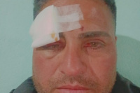 Violencia: Un futbolista sanjuanino fue golpeado y terminó con graves heridas