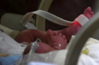 Bebé de tres meses sufre un golpe en la cabeza: tuvo que ser hospitalizado