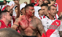 Graves incidentes entre la barra de River Plate y la Policía en Perú