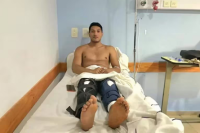 Un hombre fue a operarse una rodilla, pero despertó de la anestesia y le habían intervenido las dos por error