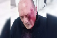 Violento asalto a un taxista en Rivadavia: lo golpearon con la culata de un arma y debieron operarlo de urgencia