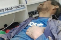 Un sanjuanino sufrió un grave accidente laboral y la familia pide ayuda para solventar los gastos